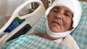 Yaşlı kadın evinin önünde dehşeti yaşadı: Yargıtay'dan köpek saldırısında emsal karar