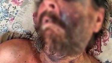 Akılalmaz vahşet! Cenazeye gelmedi diye bu hale getirdi