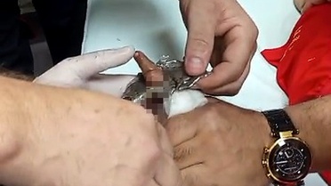 Bitlis’te parmağı çelik halkaya sıkışan çocuk itfaiye ekiplerince kurtarıldı