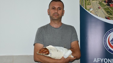 Tarlada Kaza: Bilek Ameliyatla Kurtarıldı
