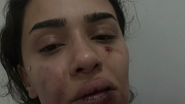 Eski sevgili, uzaklaştırma kararını hiçe sayıp dehşet saçtı! Ebru hemşirenin sesini duyun