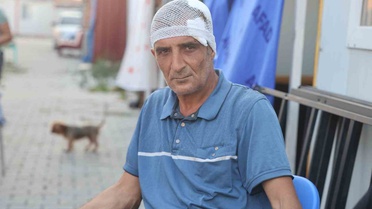 Ölümle burun buruna gelen kadının gözlerinin önünde; kardeşi, eşi ve 2 yeğeni palalı saldırıda yaralandı