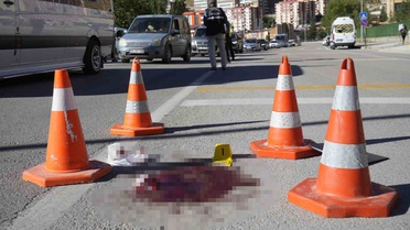 Gümüşhane'de otomobil yayaya çarptı, yaralanan kişi hastaneye kaldırıldı