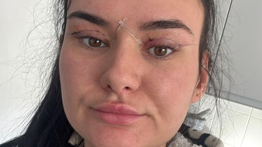 Göz kapağı ameliyatı için yurt dışına gittiler, acil servise düştüler