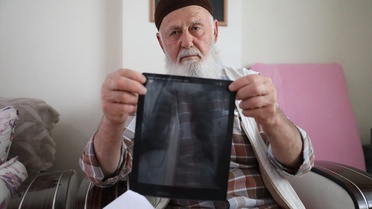 Sigaraya askerde başlayan Osman Gülay, 3 parmağını kaybetti, 16 yıldır içmiyor