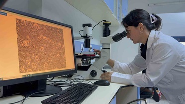 TOGÜ'lü Doç. Dr. Tosun'un akıllı ilaç taşıyıcı projesi TÜSEB desteği kazandı