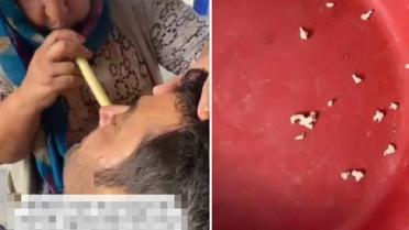 Hindistan değil Adana! Bu saçmalığa inanıp tedavi için gidenler var