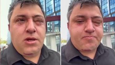 Vahim iddia: Altındağ Belediye Başkanı Tiryaki belediye işçisini darp etti
