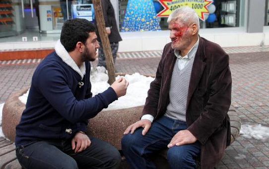 Maganda Kurşunu Hayata Küstürdü, Yüz Nakli ile Gülmek İstiyor