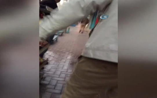 Yüzüne Kimyasal Madde Atılan Kadının Durumu İyiye Gidiyor