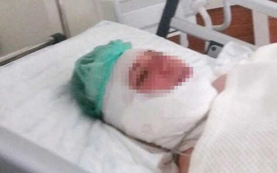 Kocasından Ölü Taklidi Yaparak Kurtulan Kadın Vahşeti İlk Kez Anlattı