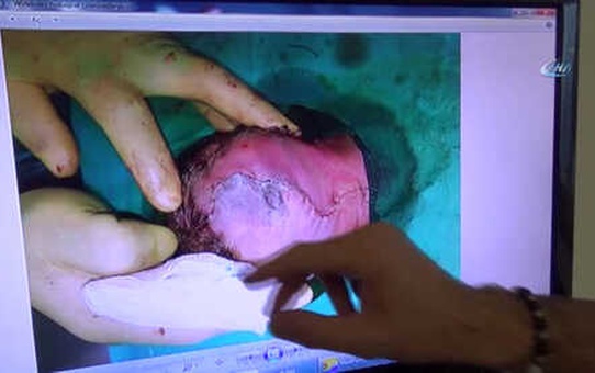 Yeşil Sahaların Doktor Hakemi 3 Günlük Bebeği Hayata Bağladı