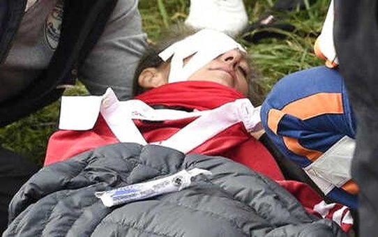 Golf Topuyla Kör Oldu