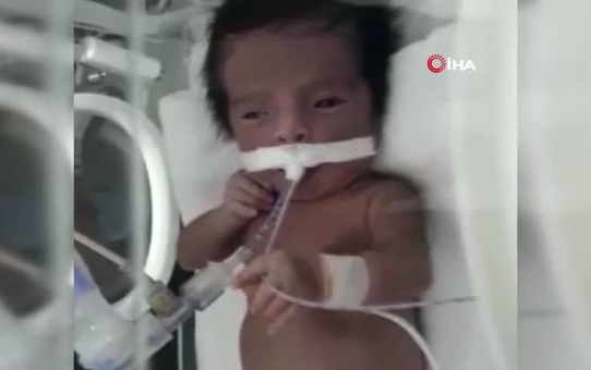 Hastalığı Teşhis Edilemeyen 5 Aylık Eymen'in Annesi, Ağlama Sesine Hasret