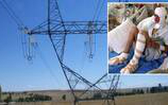 Elektrik akımına kapılan 13 yaşındaki çocuğun ayak tabanları patladı
