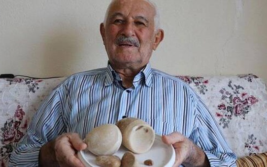 Mesanesinden 2,5 kilo taş çıktı, 'Ömür boyu saklayacağım' dedi