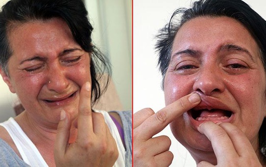 Kliniğe beyaz diş hayaliyle girdi, delirten hastalıkla çıktı! Ötenazi isteyen kadın, aldığı iş teklifi sayesinde hayata tutundu