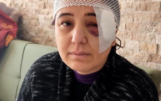 KORDON BOYUNDA YÜRÜRKEN MOTOSİKLET ÇARPTI