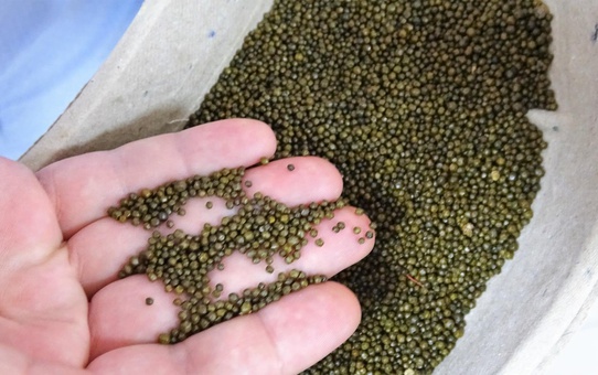 Safra kesesinden çıkanlar şaşırttı, Guinness'e başvuru yapacaklar