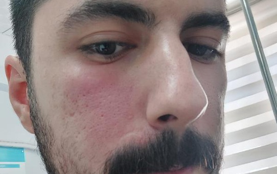 Şanlıurfa'da 2 sağlık çalışanını darbeden şüpheli tutuklandı