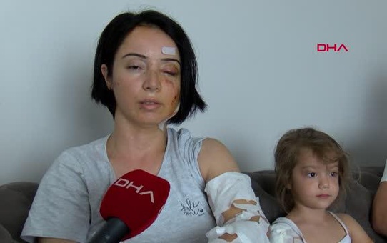 RESTORAN ÇIKIŞI KÖPEK SALDIRISINA UĞRAYAN ANNE- KIZ YARALANDI