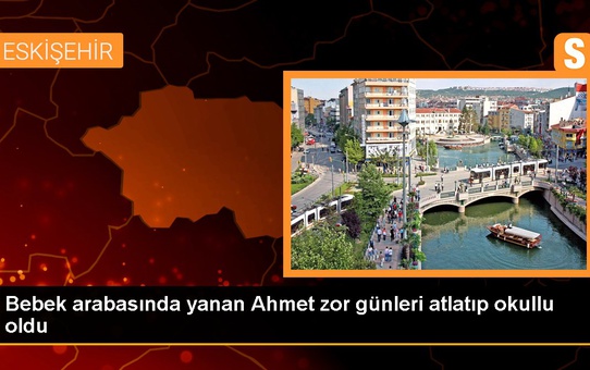Bebek arabasında yanan Ahmet zor günleri atlatıp okullu oldu