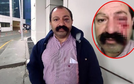 Sosyal medya fenomenini ev sahibi darp etti: Öyle bir vurdu ki kendime gelemedim