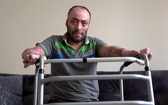 TTK Amasra Müessesi'nde yaşanan grizu faciasında ağır yaralanan madenci anlattı