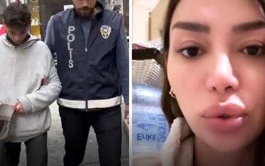 Didem Kınalı'nın 70 Bin Liralık Telefonu Çalındı