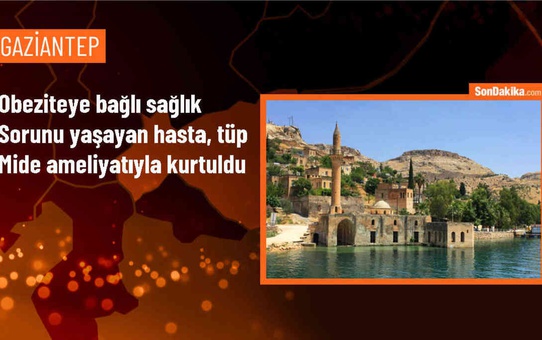 Medical Point Gaziantep Hastanesi'nde Obezite Ameliyatıyla Hasta Sağlığına Kavuştu