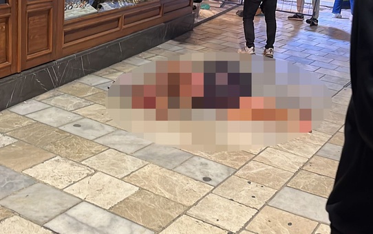 Kardeşinin Marketinde Yangın Çıkaran Erkan Sekmen Yaralandı