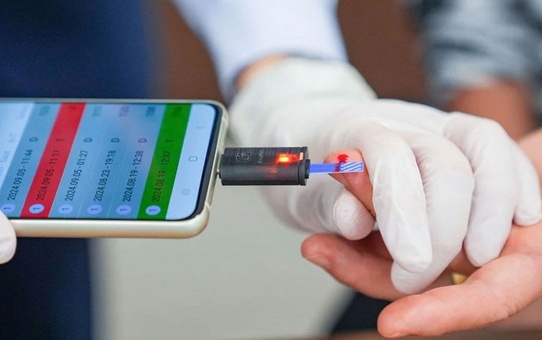 Türk Bilim İnsanlarından Dev Adım: Cep Telefonuyla Şeker Ölçümü İmkânı!