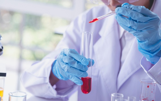 Prof. Dr. Taşova: Türkiye'de HIV olgusu 4 kat arttı
