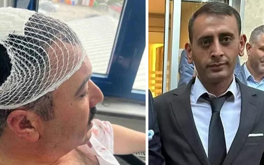 Belediye başkan yardımcısına şekerlikle saldıran Yeniden Refah Partili tutuklandı