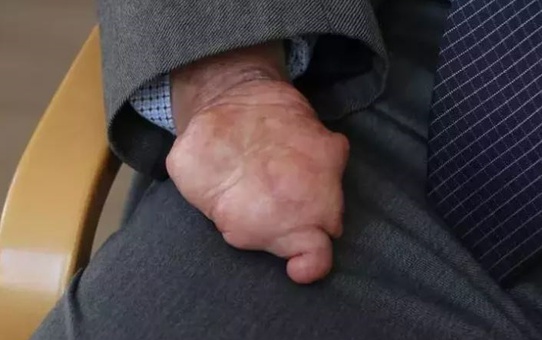 Fethi Öğretmen'in Başarısı
