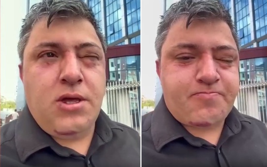Vahim iddia: Altındağ Belediye Başkanı Tiryaki belediye işçisini darp etti