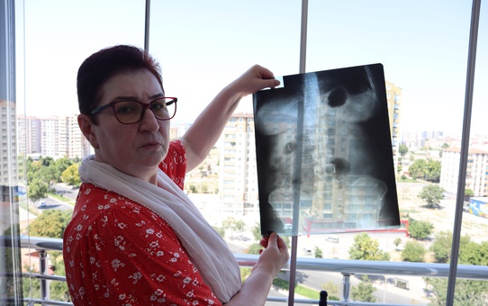 22 Yıldır Karnında Ameliyat İğnesiyle Yaşıyor