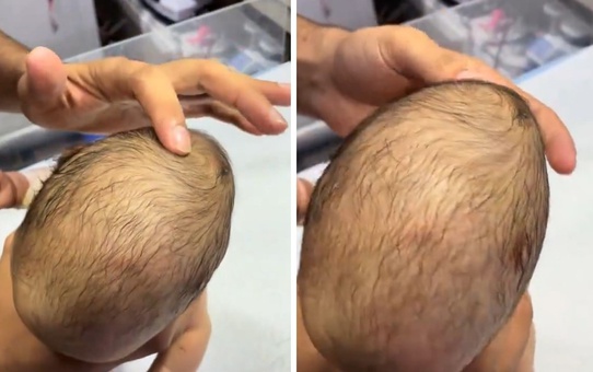 Yeni doğan bebeğin bıngıldağına basan doktorun gördüğü manzara korkunç