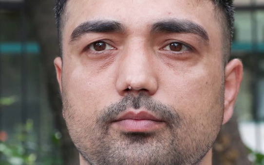 Burun ameliyatına girdi, başına gelmeyen kalmadı! İşini bile kaybetti
