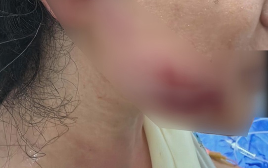 Diyarbakır'da maç sonrası havai fişek 7. kat balkonunda patladı, 2 kardeş yaralandı