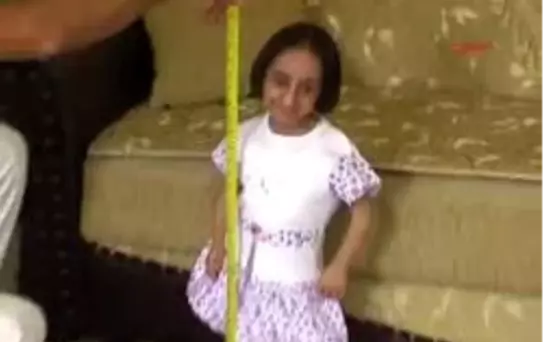 Kadirli - Dünyanın En Kısa Boylu İnsanı Osmaniyeli