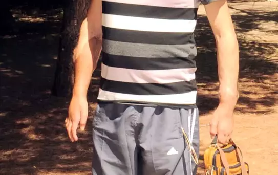 Geçen Yıl Kol Nakledildi, Bilek Güreşi Bile Yapıyor