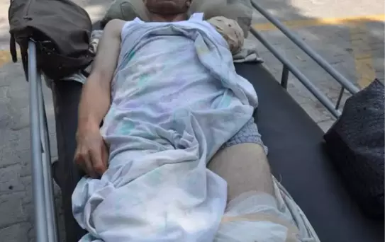 Kazada Kopan Kolun Dikilememesinde 'İhmal' İddiası