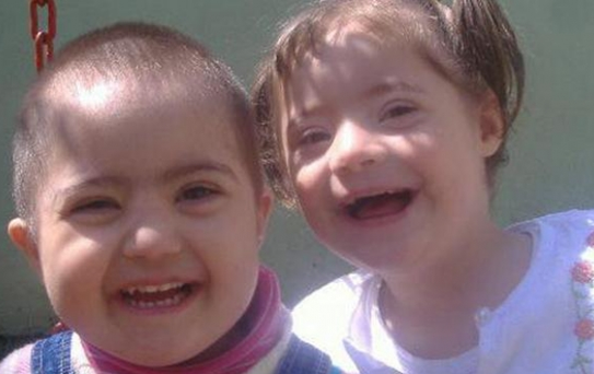 'Down Sendromu' Yüzde Yüze Yakın Tespit Edilecek