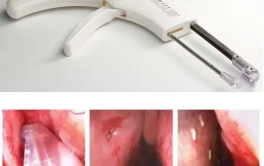 Tamponsuz Burun Ameliyatı