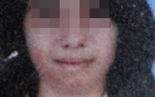 Genç Kız, Yüzündeki Yanık İzi Yüzünden Ölüme Atladı