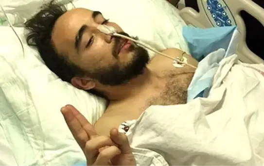 Gezi'de Gözünü Kaybetti, Suruç'ta Bacağından Yaralandı