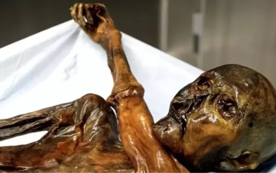5 Bin 300 Yıllık Mumya Kansere Çare Olabilir mi?