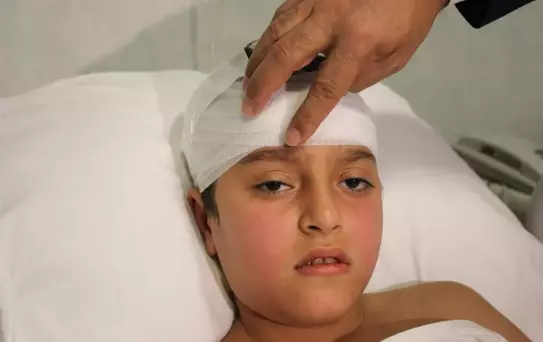 Beyninin hastalıklı lobu alındı, nöbetler kesildi