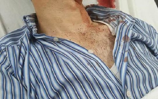 Ankara'daki Dehşet Mağdurunun Evinde Buruk Bayram